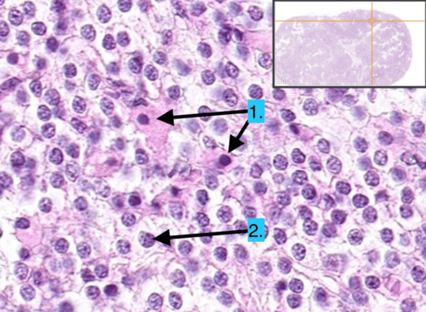 <p>What are the 2 types of cells that make up the Parathyroid?</p>