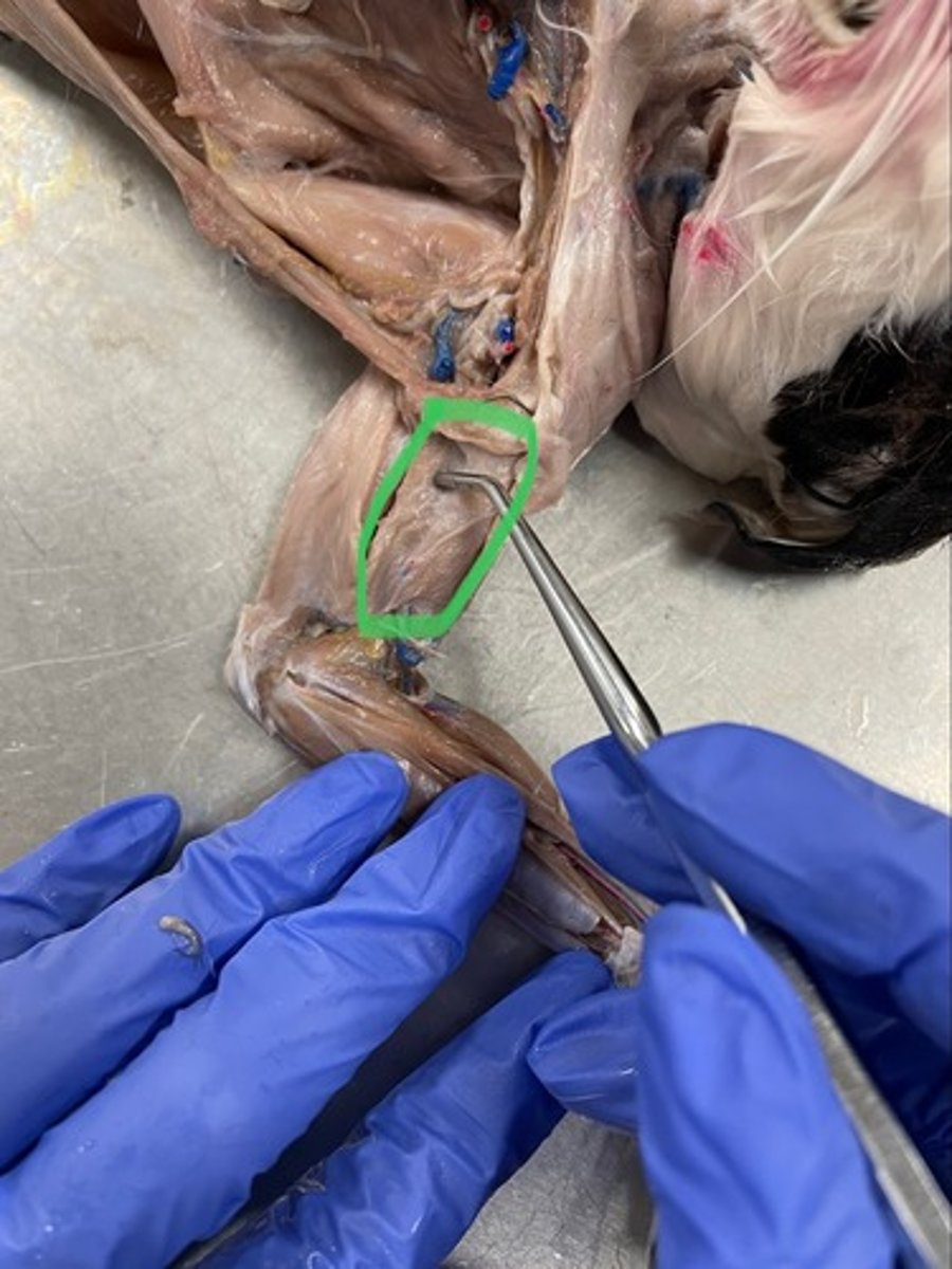 <p>O: scapula</p><p>I: radial tuberosity of radius</p><p>A: flexes elbow</p>