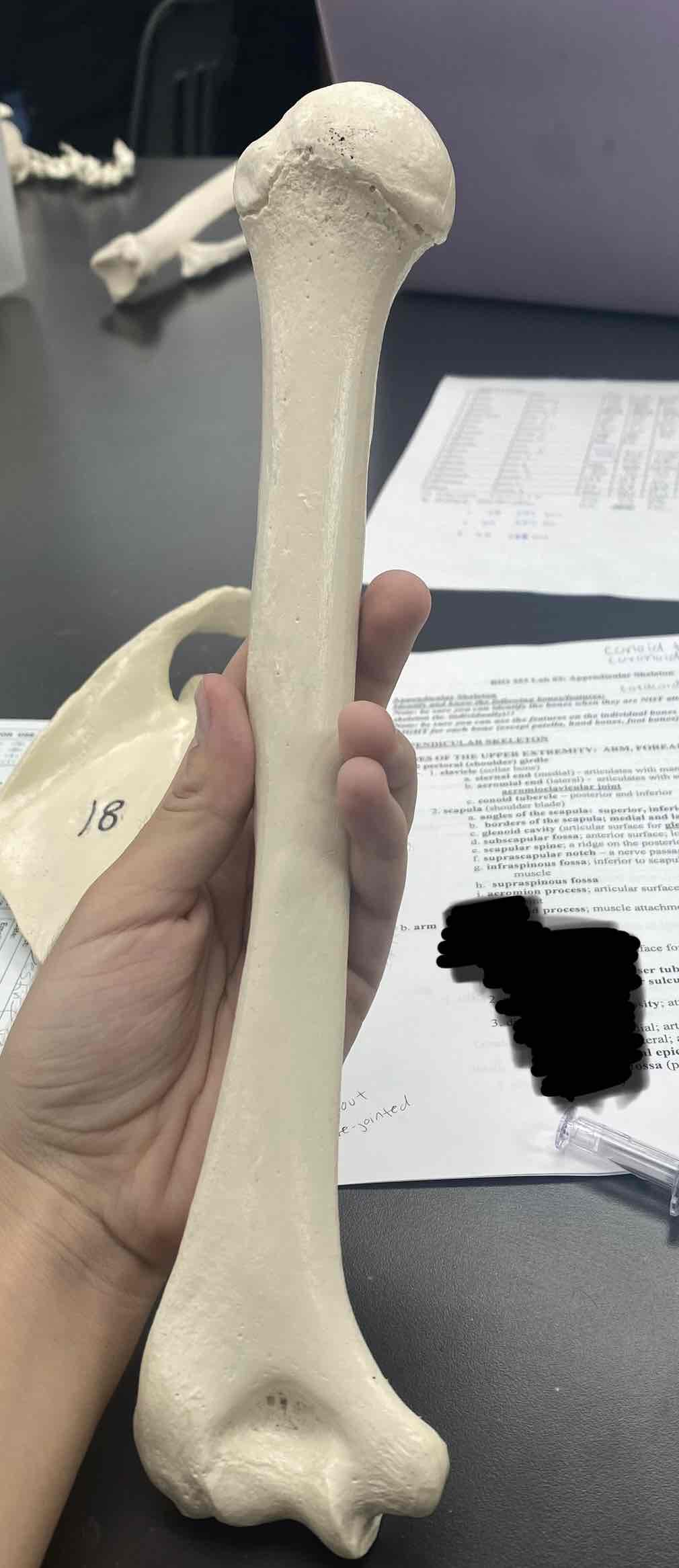 <p>name the bone </p>