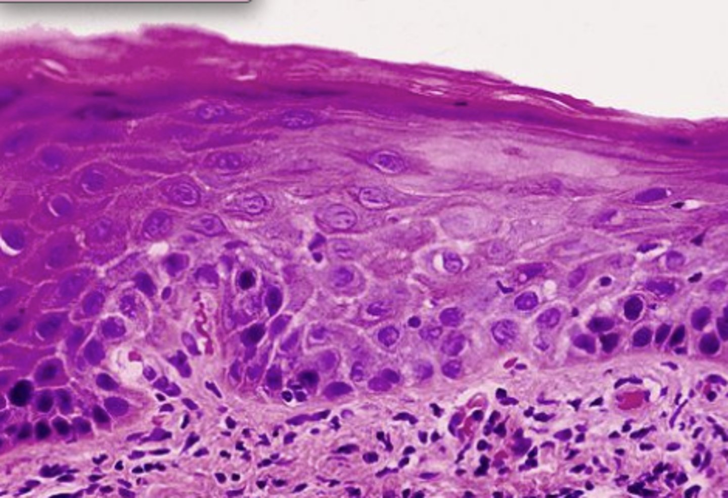 <p>lower 1/3 of epithelium</p>