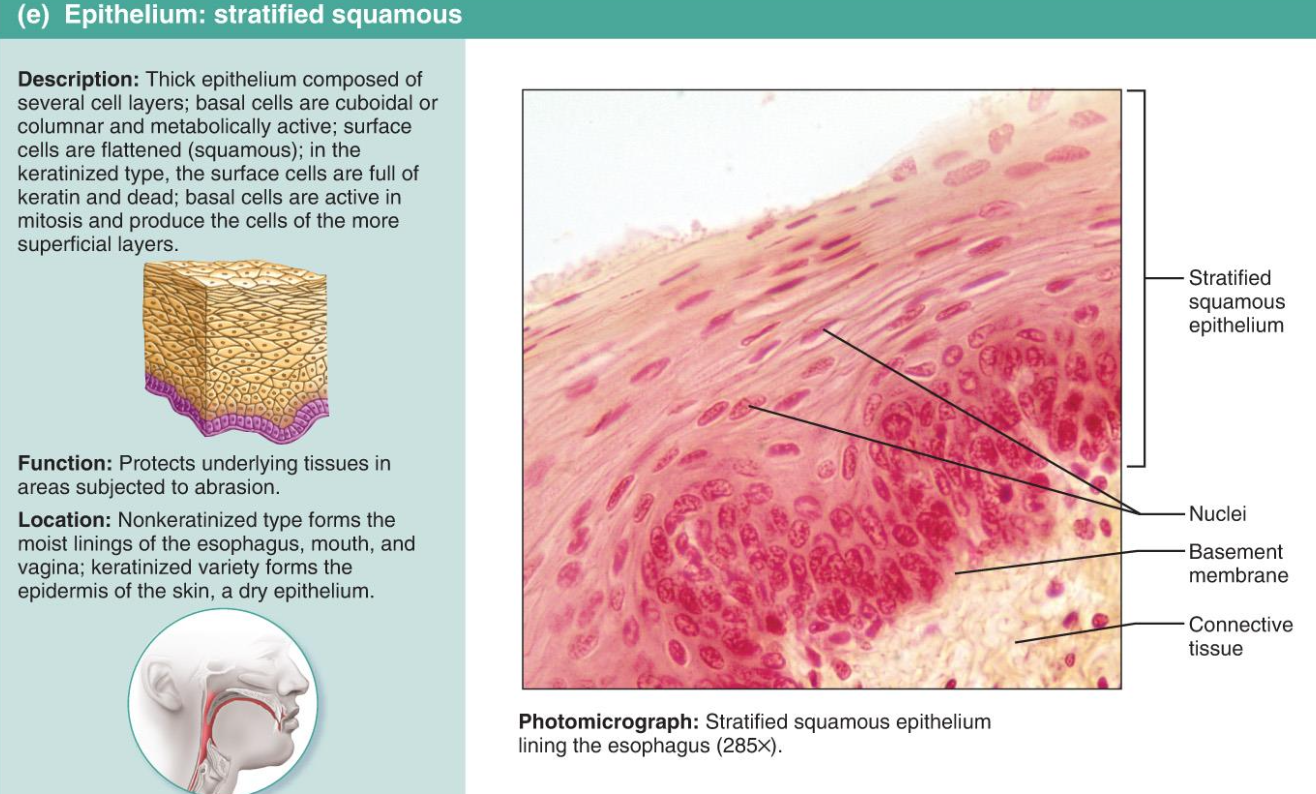 <p>Starified Squamous</p>