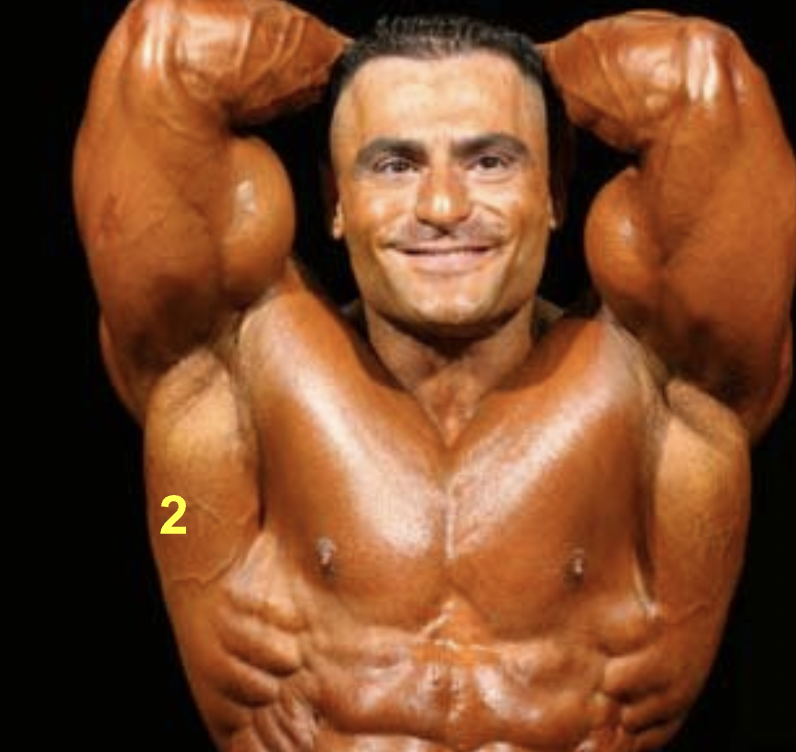 <p>What muscle is indicated by “2”?</p>