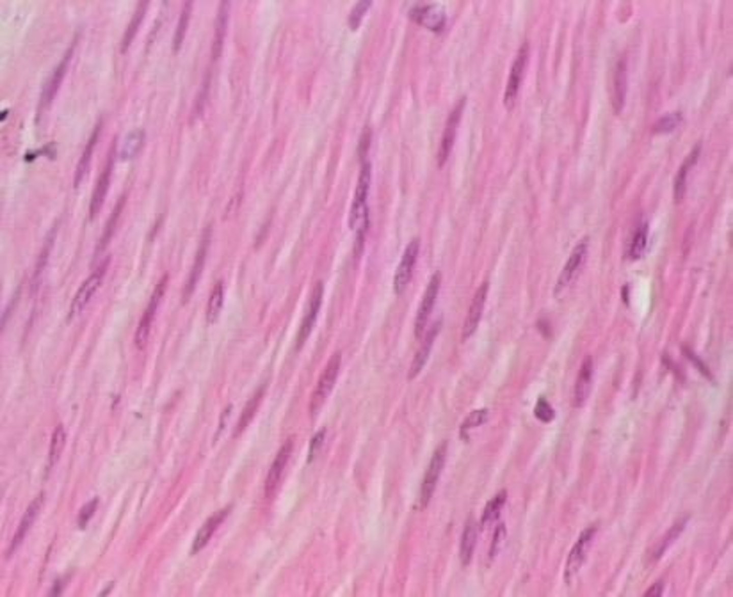 <p>What type of tissue is this?</p>