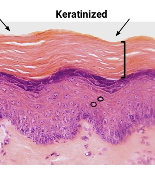 <p>What are the locations of Keratinized Stratified Squamous Epithelium? </p>