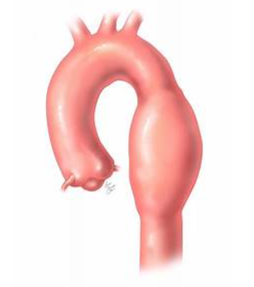 <p>In this diagram the arrows indicate blood flow. Note the swirling blood flow encapsulated next to artery? What is this? </p>