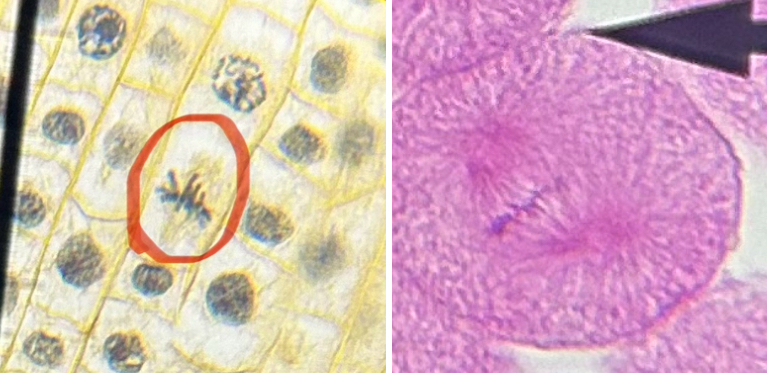 <p>What phase is the fish and onion cell in?</p>