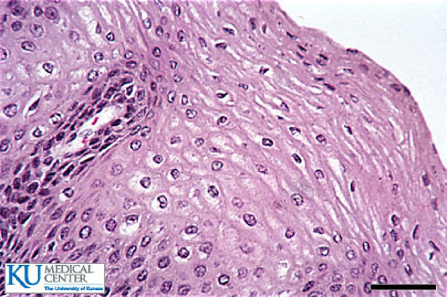 <p>Many layers, moist surface cells alive; Function: Protection from friction; Location: Mouth, esophagus, vagina.</p>