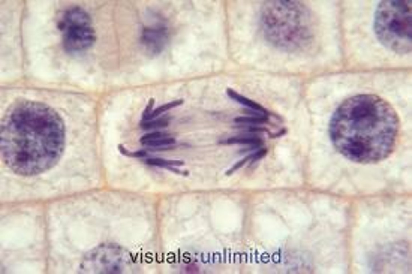 <p>chromosomes seperate into 2 clusters at the poles of the cell. trailing chromosomes arms point back to center in some examples. Microtubles still kinda form a spindle but much more irregular.</p>