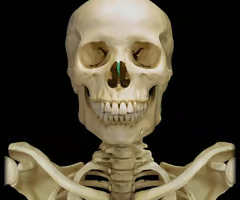 <p>superior portion of the bony nasal septum </p>
