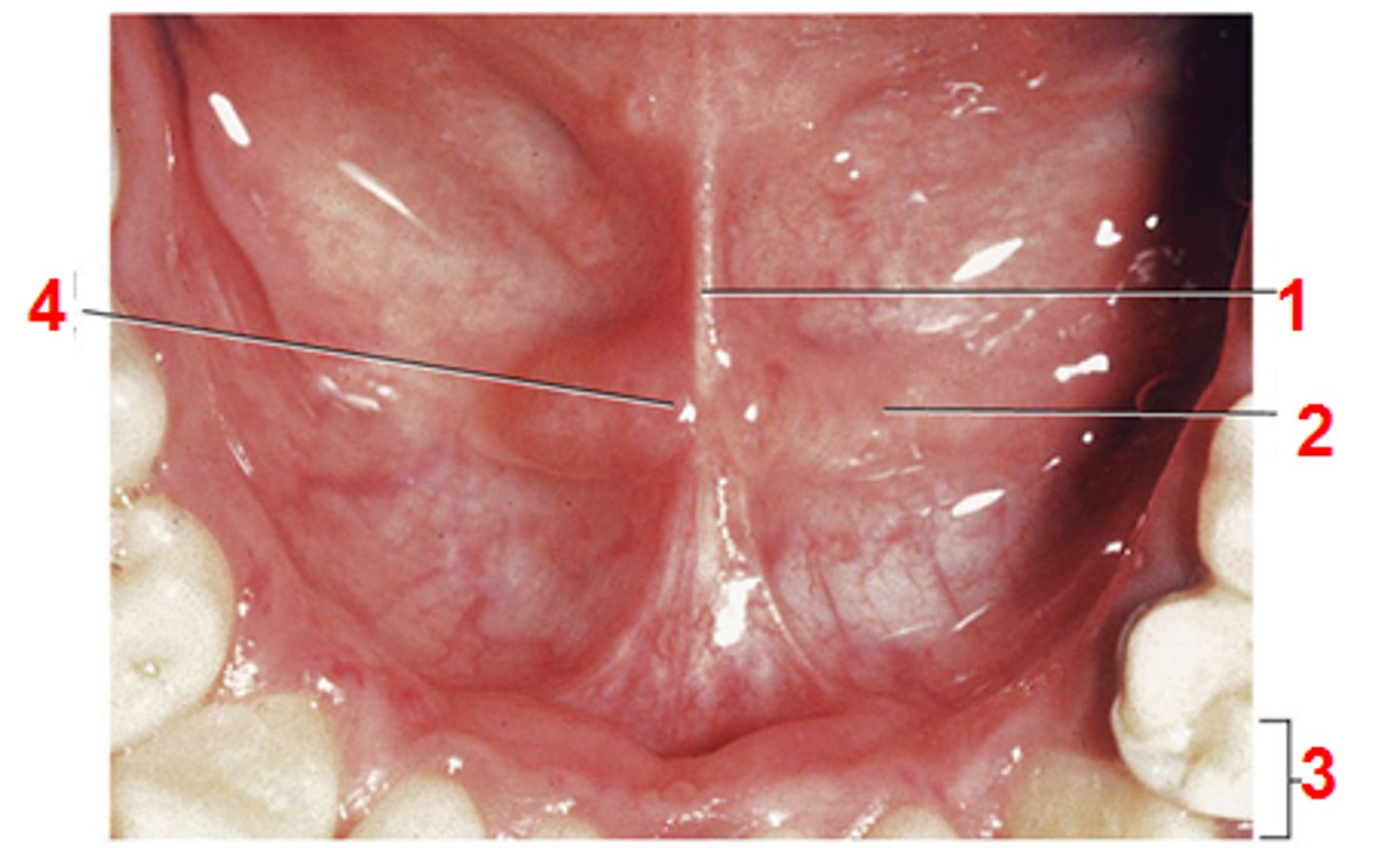 <p>identify parts under the tongue</p>