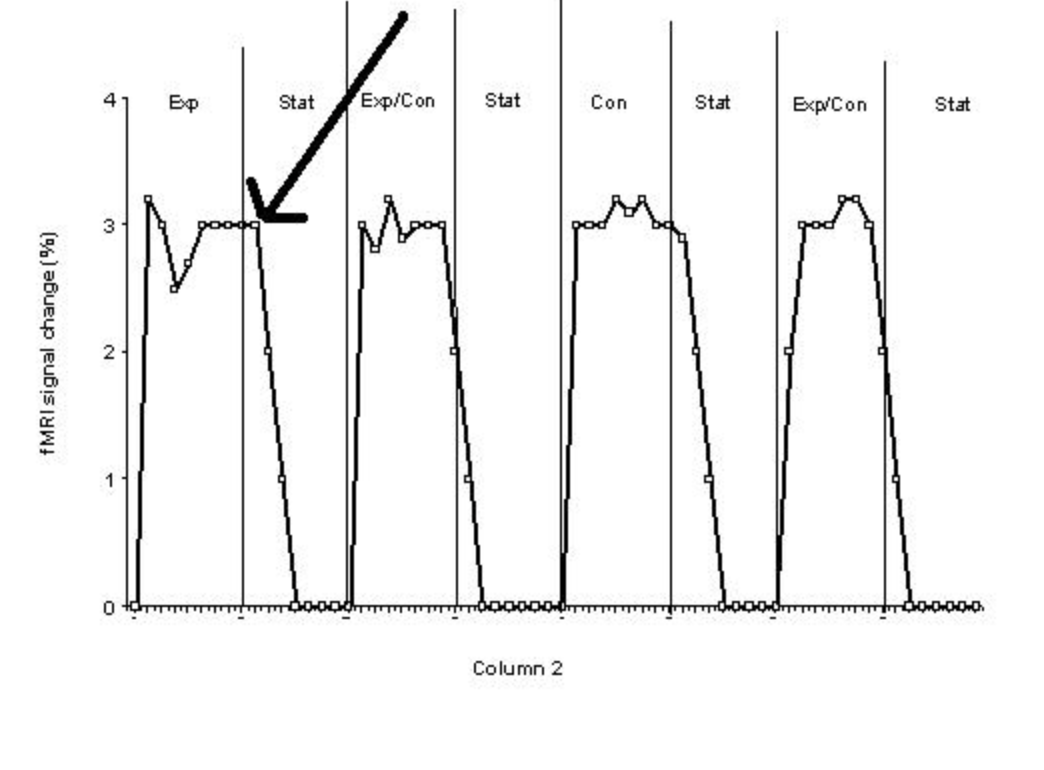 <p><span style="font-size: medium">Consider the graph above showing the brain activity in the motion processing area (3 points)</span><br><br><span style="font-size: medium">A) Label/circle one part of the graph that is due to the hemodynamic lag (1).</span><br><br><span style="font-size: medium">B) Label/circle all parts of the graph where the subject experiences the motion after-effect (1)</span><br><br><span style="font-size: medium">C) Consider where the arrow is pointing to on the graph. What problem/limitation of fMRI is related to this point on the graph?</span><br><span style="font-size: medium">(1) Hint: the answer is NOT the hemodynamic lag</span></p>