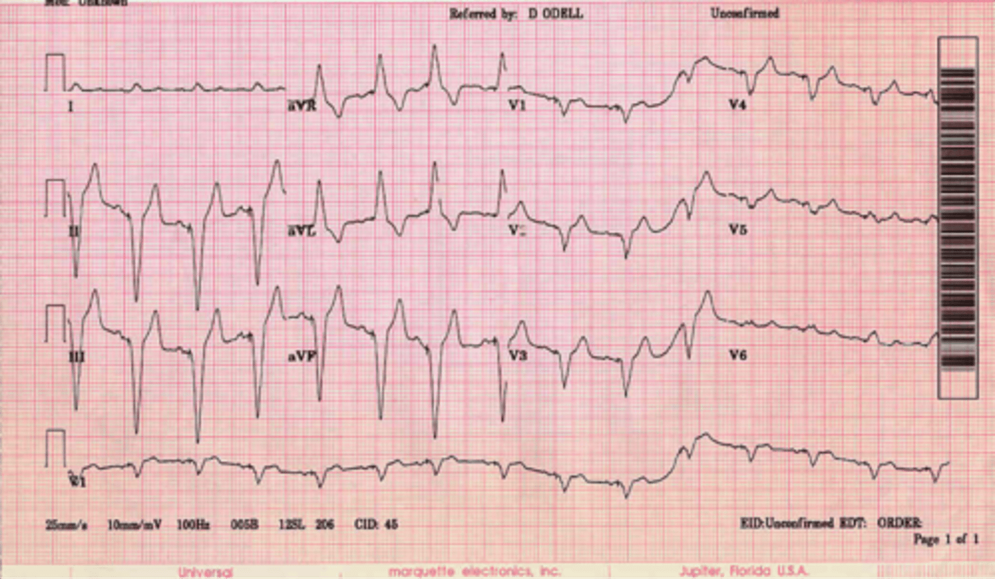 <p>dẫn tới điều gì</p>