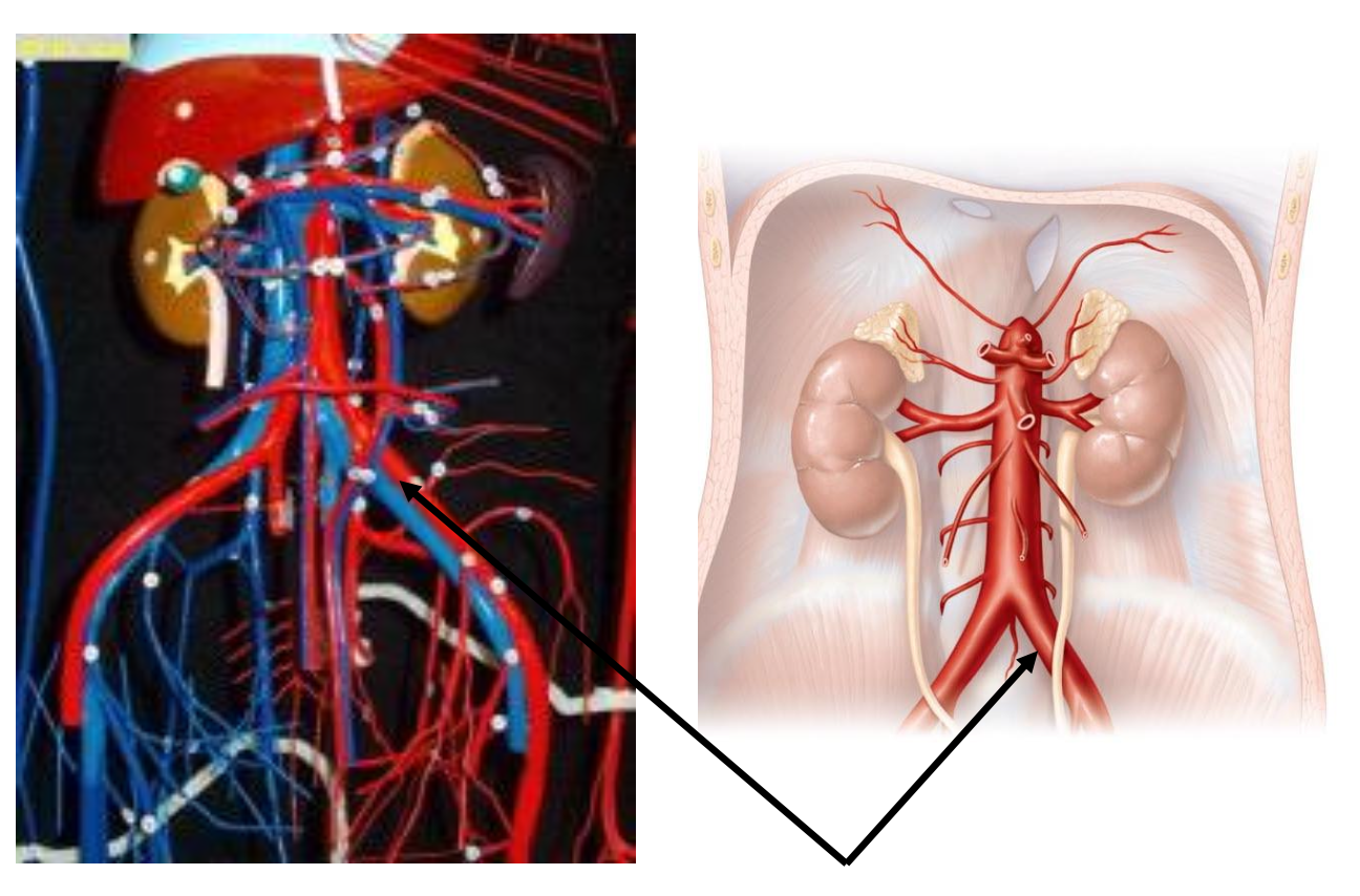 <p>The arrow on the vascular tree is pointing to </p><p></p><p>a. Gonadal artery</p><p>b. Renal artery</p><p>c. Superior mesenteric artery</p><p>d. Common iliac artery</p>