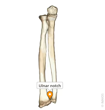<p>On the distal/ medial aspect of <strong>radius </strong>(accommodates ulna) </p><p></p>