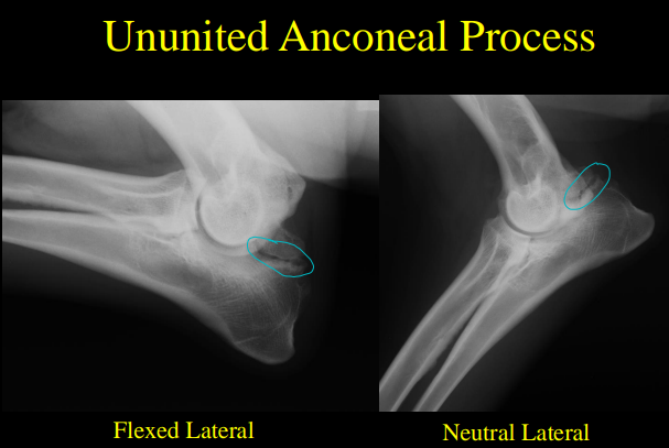 <p>Ununited Anconeal Process</p>