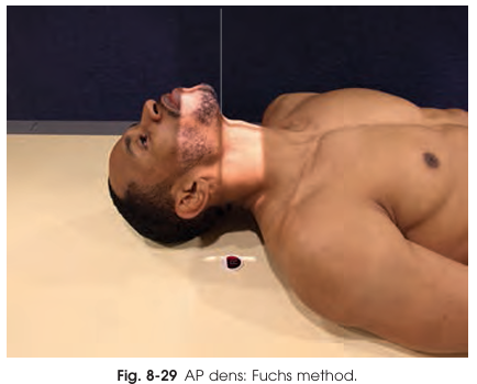 <p>Where should the central ray be directed in the Fuchs Method AP projection?</p>