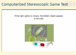 <ul><li><p>Computer game tests are now being employed as measure of stereoacuity (Portela- Camino et al., 2021). </p></li><li><p>Allows for more intervals to be measured. </p></li><li><p>Potential for better management of Amblyopia</p></li></ul><p></p>