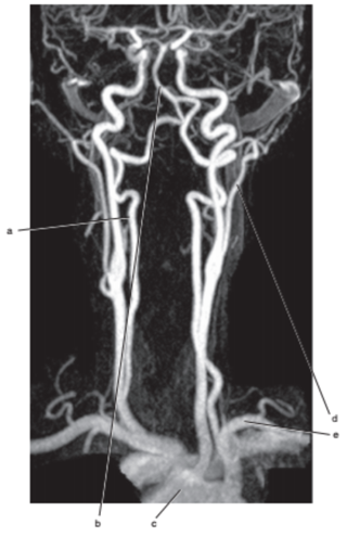 <p>What is letter e ?</p>
