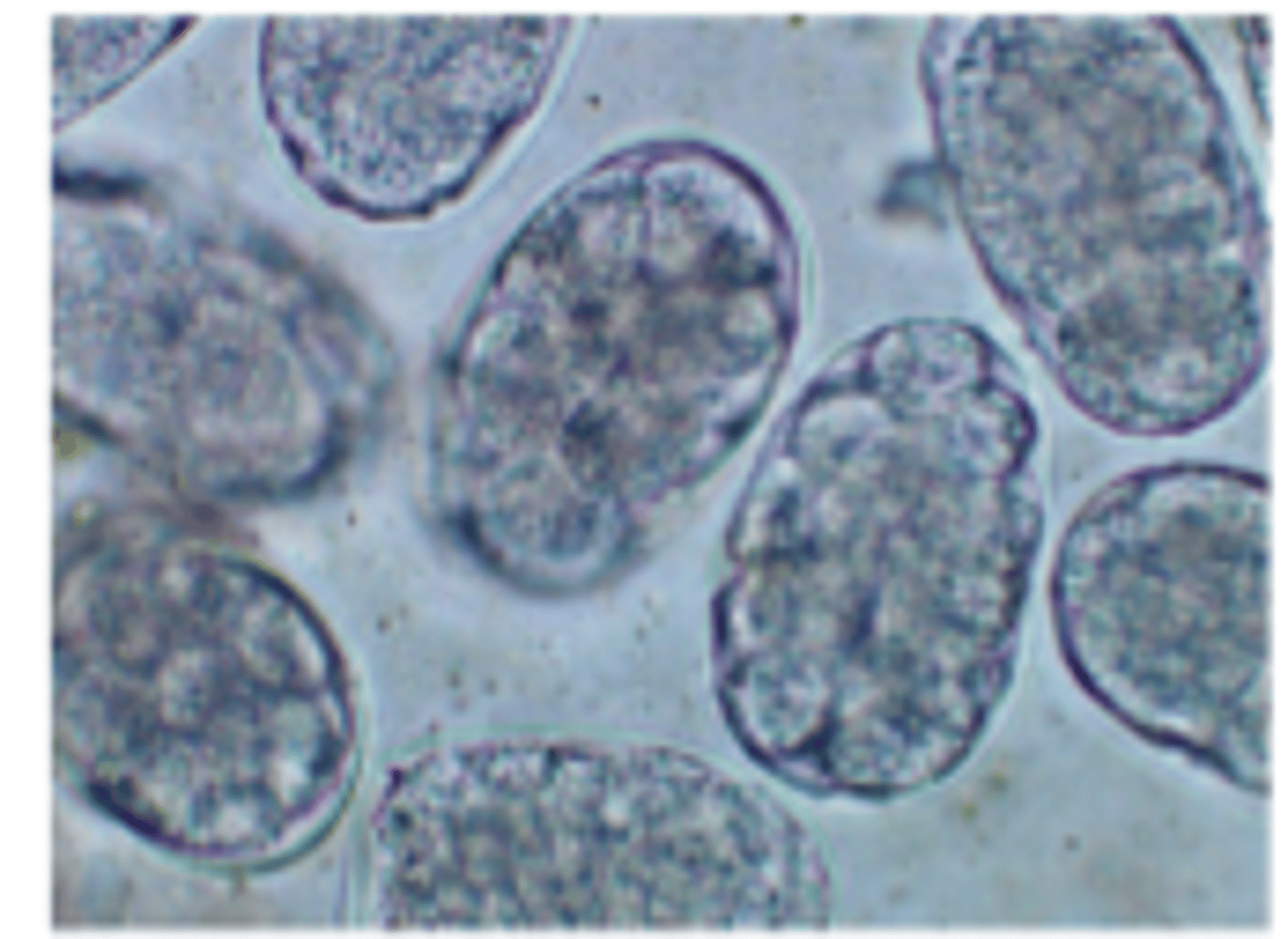 <p>Ancylostoma caninum</p><p>-Large buccal capsule w/ 3 pairs of large teeth</p><p>-males w/copulatory bursa</p>
