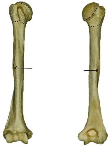 <p>rough ridge going down humerus bone</p>