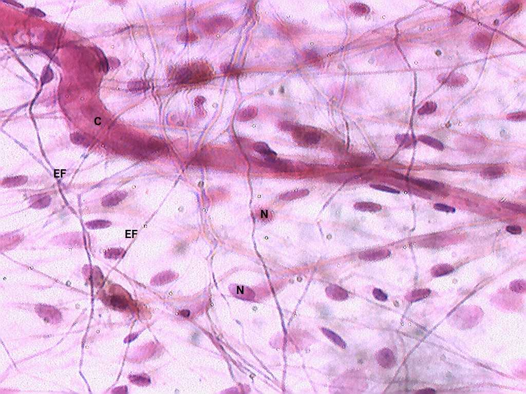 <ul><li><p>Characteristics:</p><ul><li><p><strong>LOOSE CONNECTIVE TISSUE</strong></p></li><li><p><strong>CONTAINS FIBROBLASTS</strong></p><ul><li><p><strong>PRODUCE ELASTIC AND COLLAGEN FIBERS</strong></p><ul><li><p>Arranged in a <strong>MESSY, IRREGULAR PATTERN</strong></p></li></ul></li></ul></li></ul></li><li><p>Location: <strong>DERMAL LAYER </strong>of the <strong>SKIN</strong></p></li><li><p>Function: <strong>CUSHIONING, HYDRATION, ELASTICITY, STRENGTH</strong></p><ul><li><p>Think CHES</p></li></ul></li></ul><p></p>