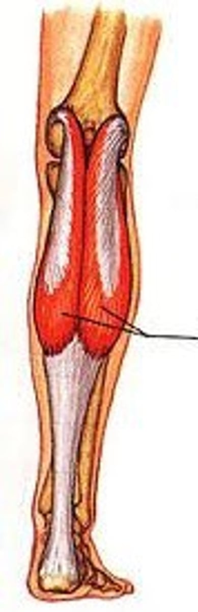 <p>Medial and lateral condyle of the femur</p>