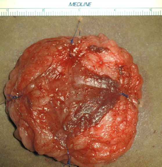 <p>10% neutral buffered formalin</p><p>use 1:10 ratio of tissue to formalin</p>