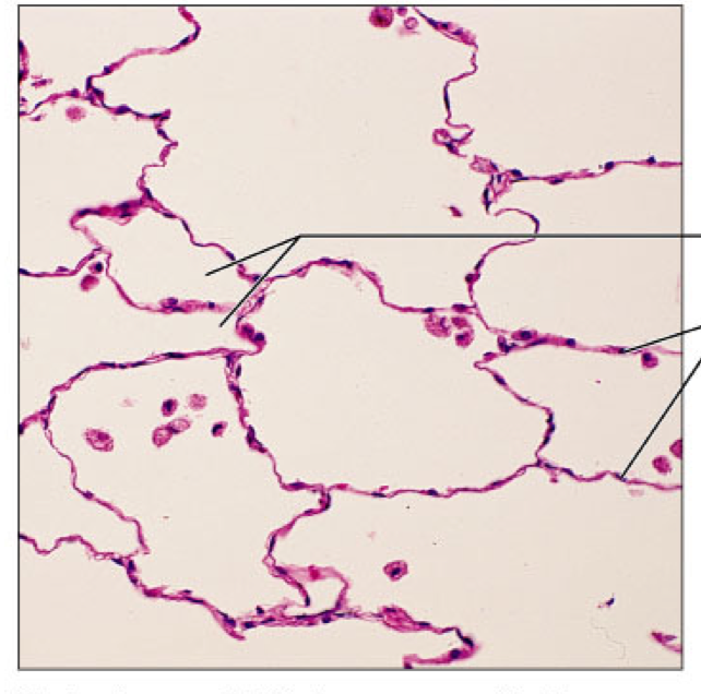 <p>simple squamous</p>