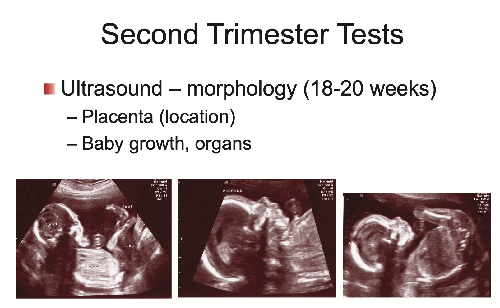 <p><strong>Ultrasound</strong> - morphology (18-20 weeks)</p><ul><li><p>placenta (location) - not bottom part of placenta grows last</p></li><li><p>baby growth, organs</p></li></ul><p></p>