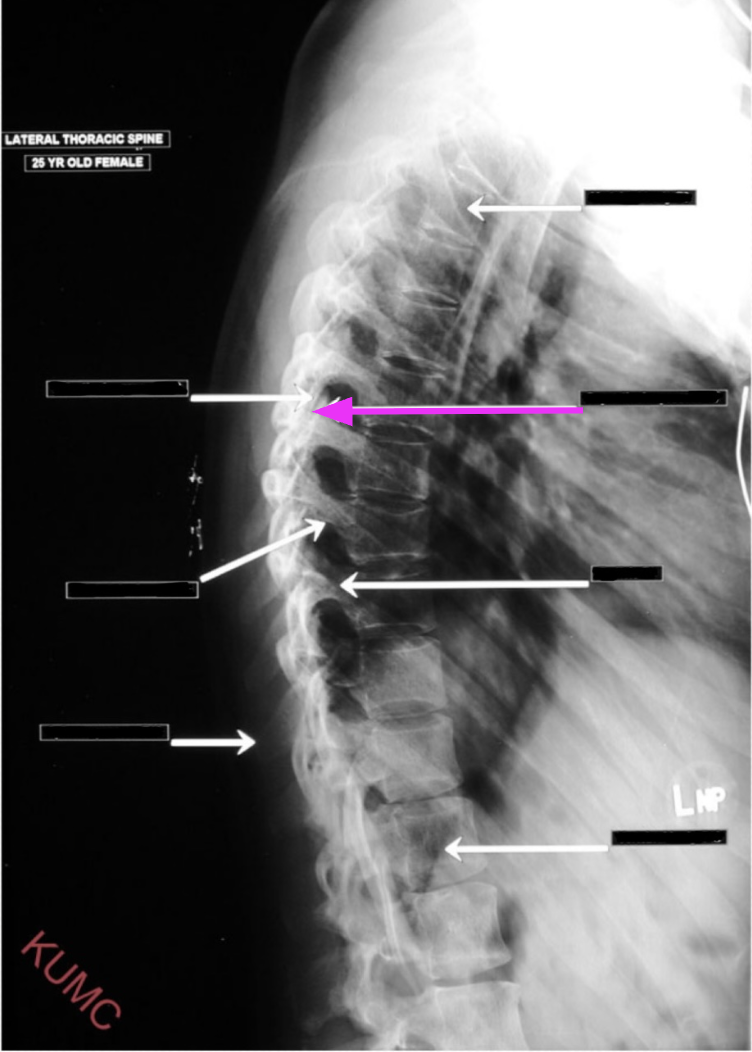 <p>What structure is referenced by the arrow highlighted in pink?</p>