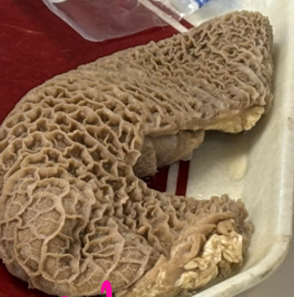 <p>What is pictured? </p>