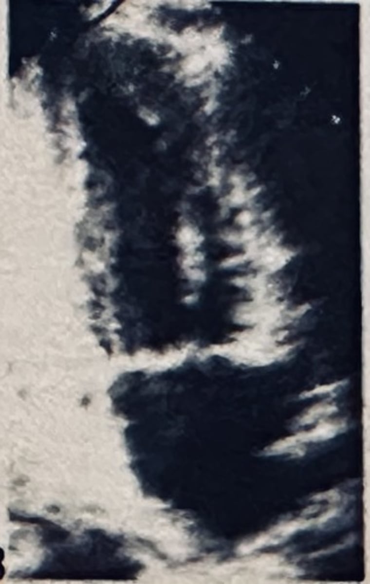 <p></p>