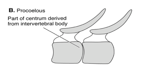 A vertebral articulation in the holospondyl condition characterized by a ball and socket for more motion in most directions and the CONVEX portion being found ANTERIORLY