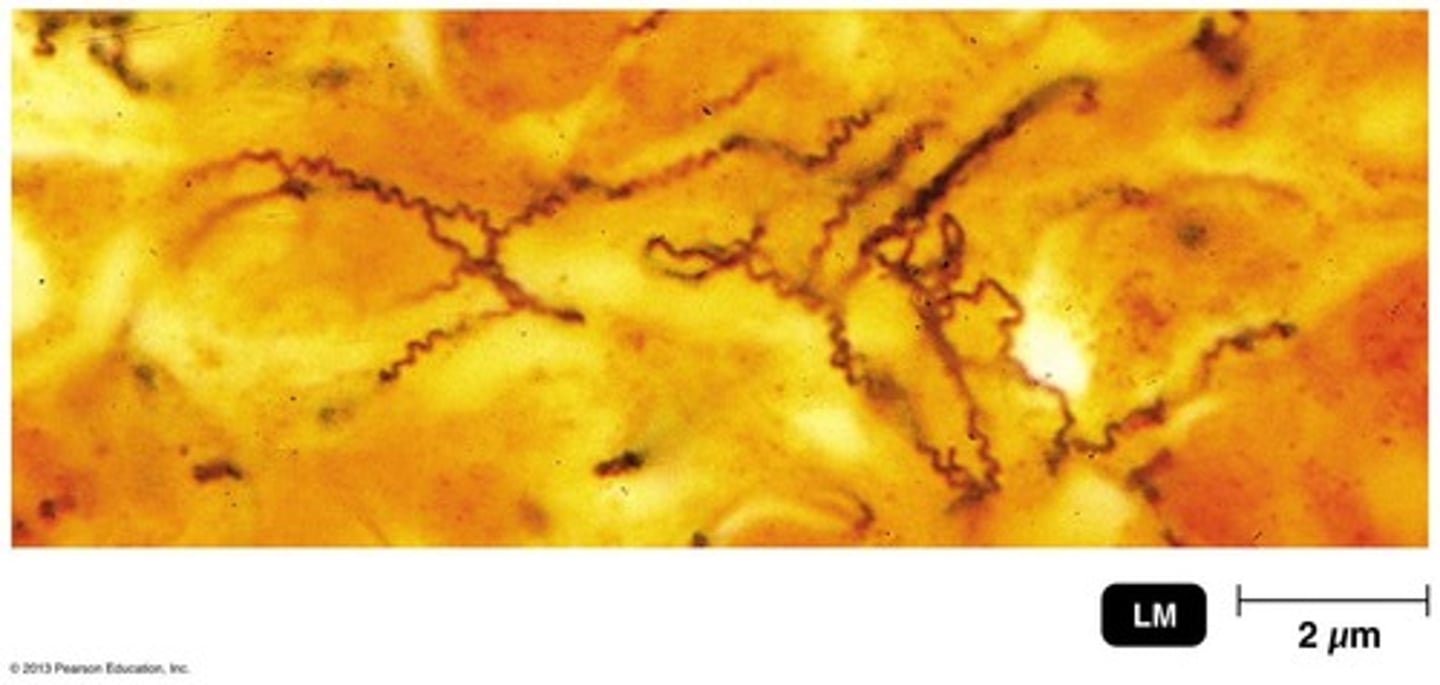 <p>Treponema pallidum, a gram-negative spirochete.</p>