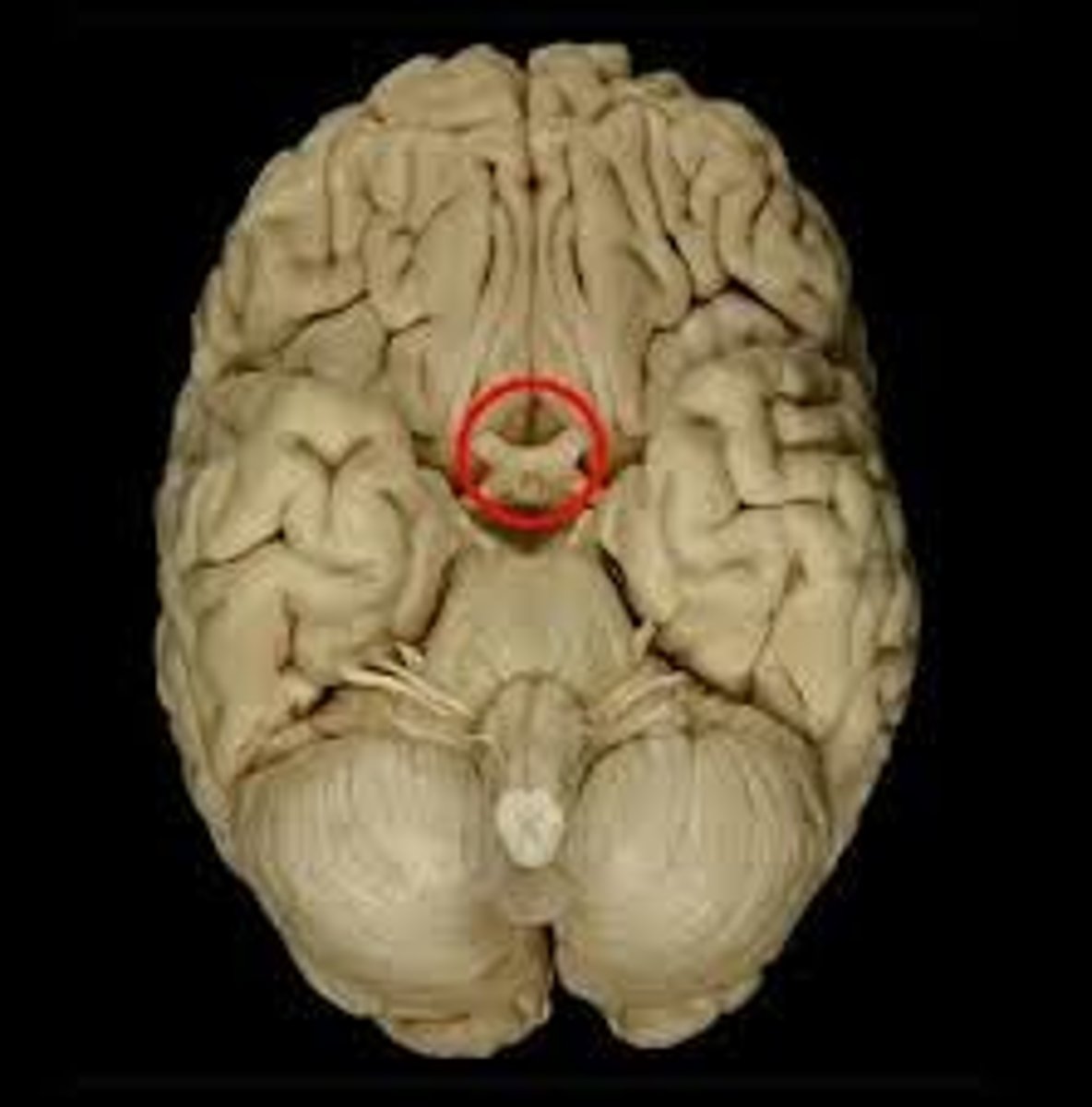 <p>What part is circled in red?</p>