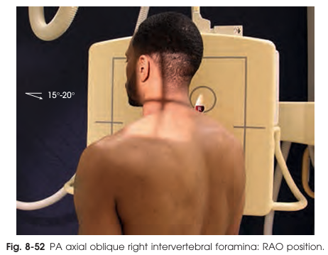 <p>IR Centering&nbsp;for the PA axial oblique projection</p>