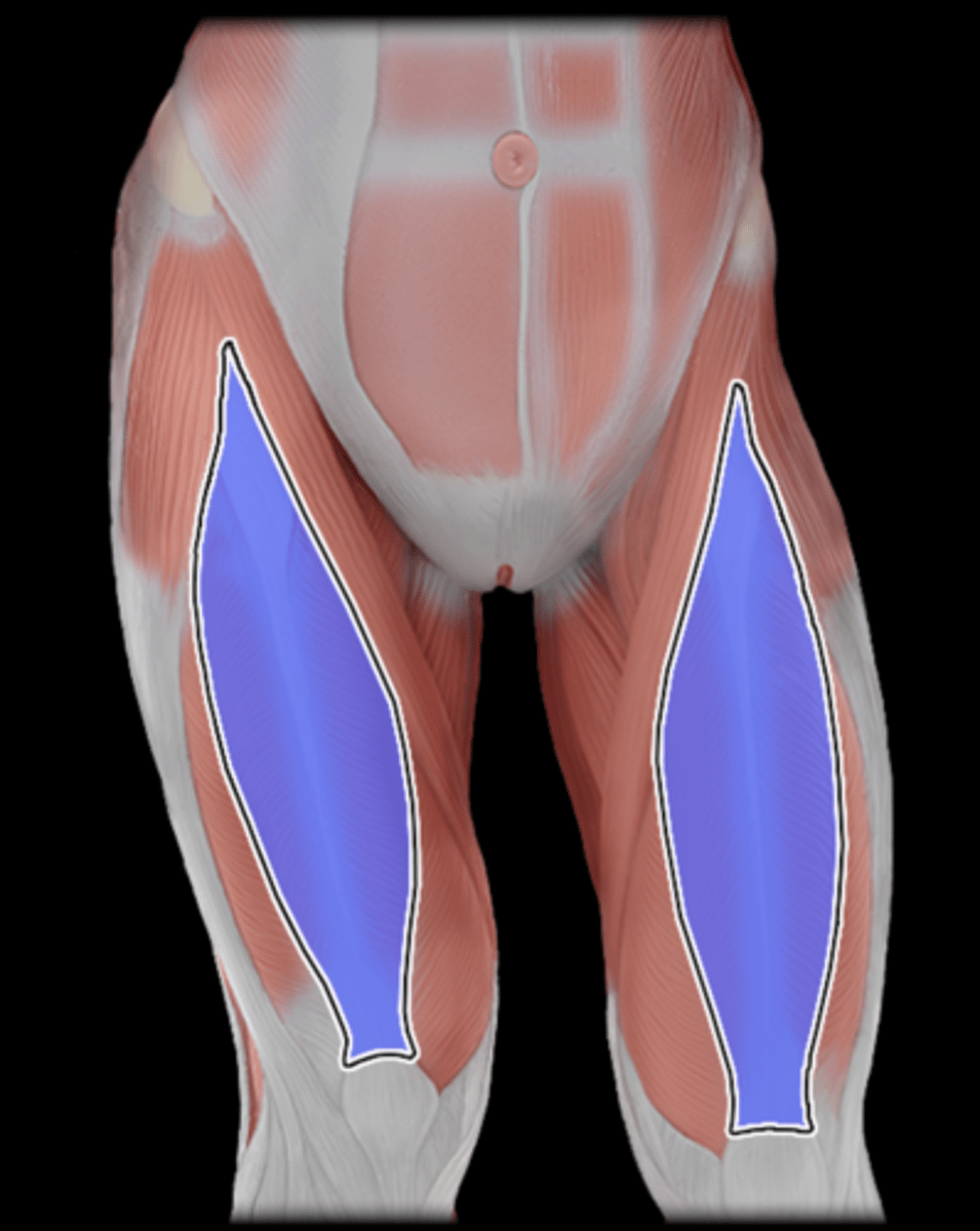 <p>What Muscle Is Highlighted?</p>