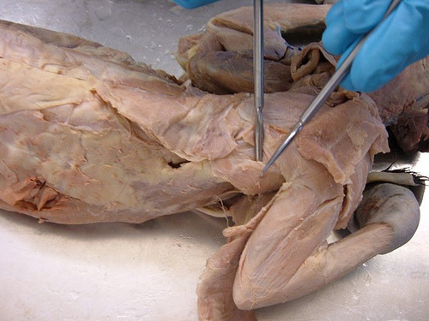 <p>Origin: Scapula</p><p>Insertion: Humerus</p>