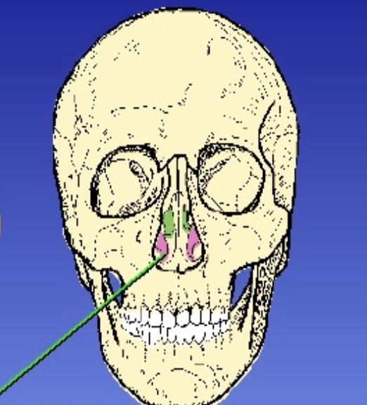 <p>What is the green? </p>