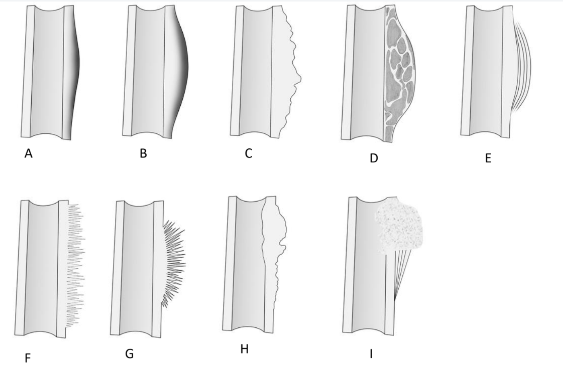 <p>What do we see in the diagrams?</p>