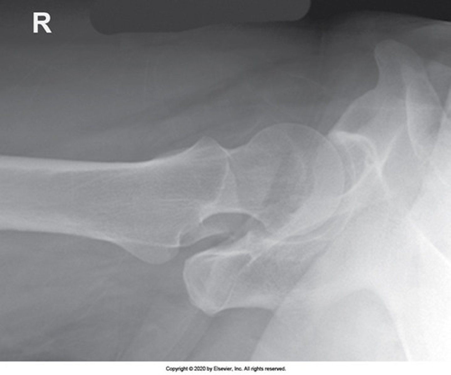 <p>Identify the projection:</p><p>AP hip</p><p>AP oblique hip</p><p>Lateral hip</p><p>Axiolateral hip</p>