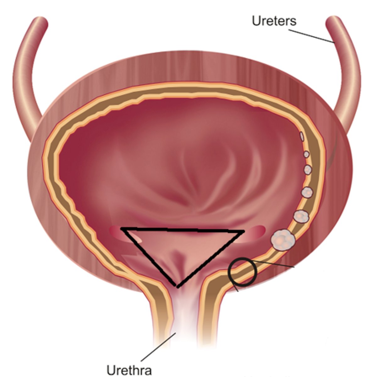 <p>The trigone is a smooth triangular region of the bladder, marked by the openings of the ureters and the urethra.<br>-"funnel into the urethra"</p>