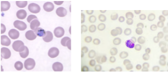 <p>What is the genus, species, and stage of this parasite?</p>