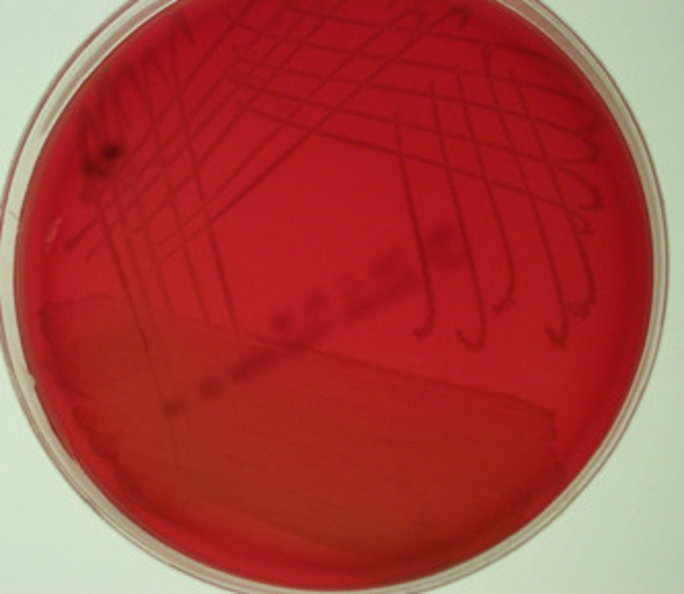 <p>-no visible change in agar around the colony</p><p>-no breakdown of RBC</p><p>-staphylococci / streptococci</p>
