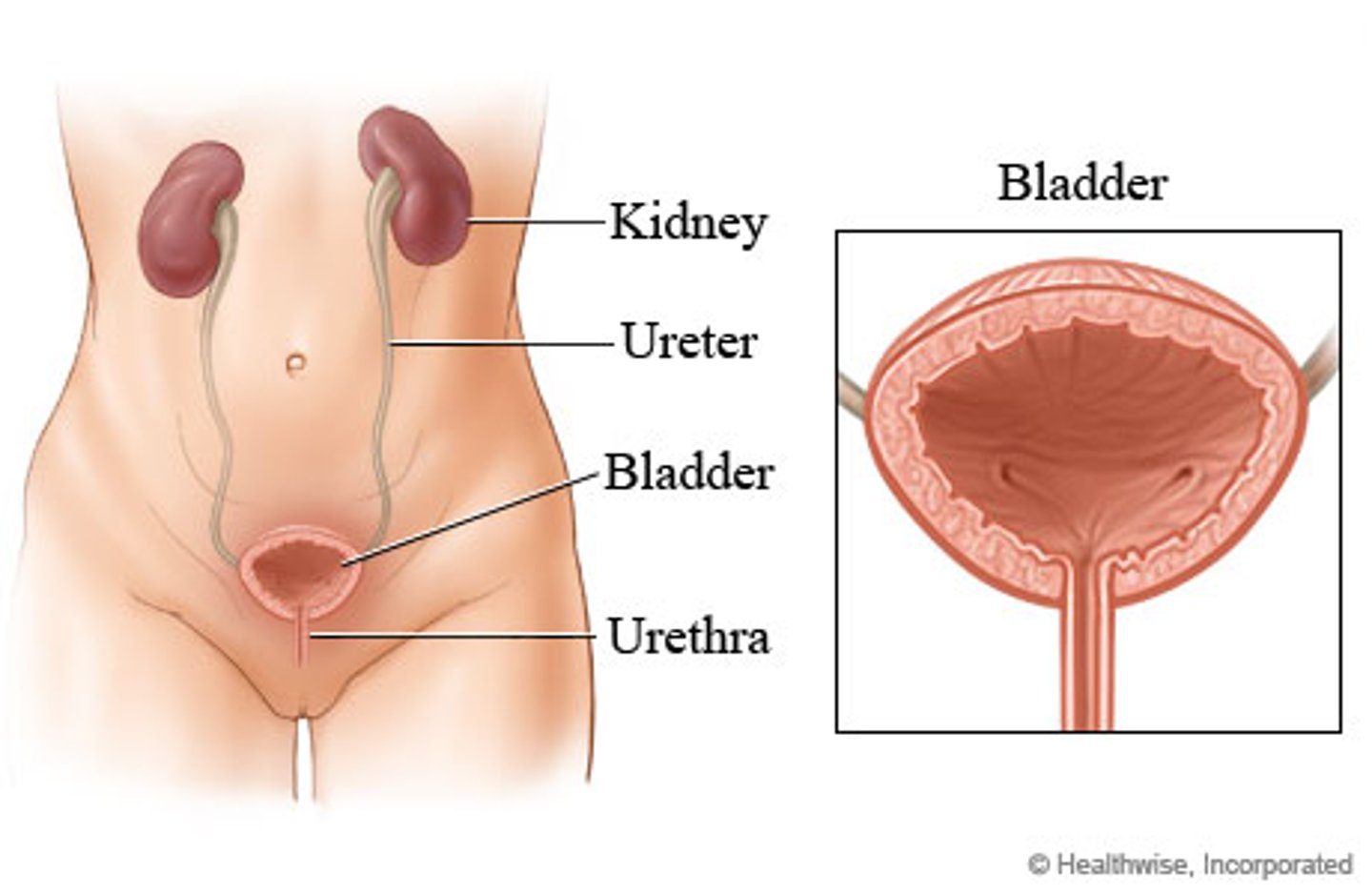 <p>hole near base of bladder on table 5,7</p>