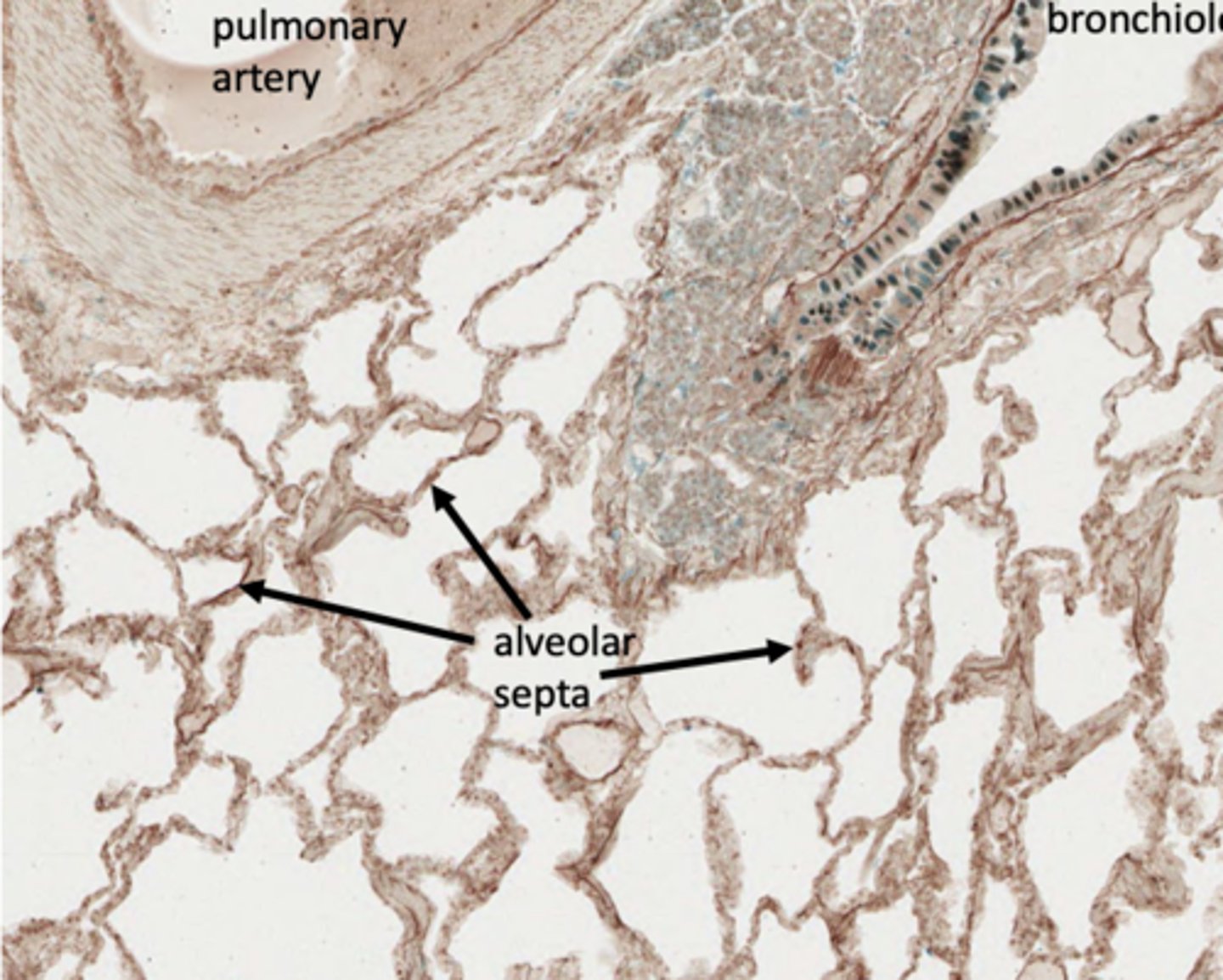 <p>This is stained with what to show a key feature of alveoli?</p>