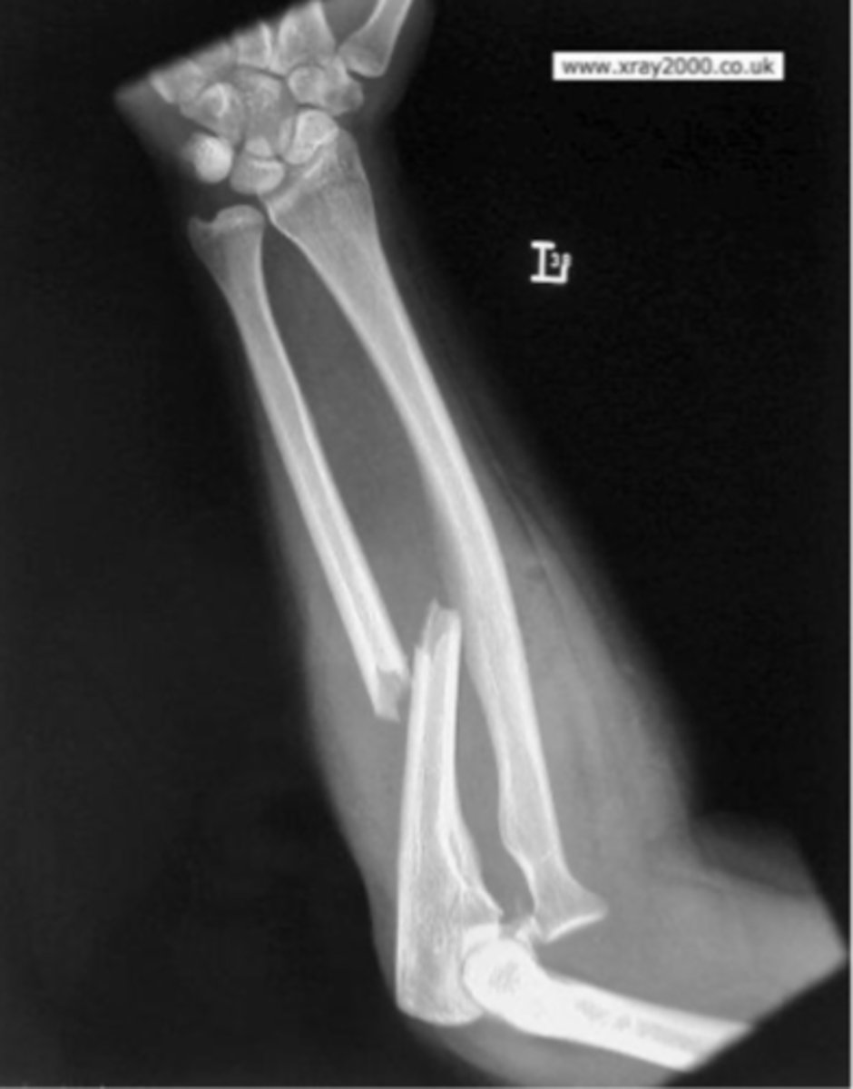 <p>What is the issue?</p>