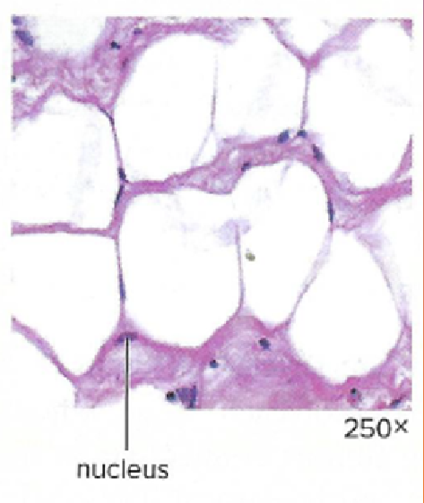 <p>What tissue type is this?</p>