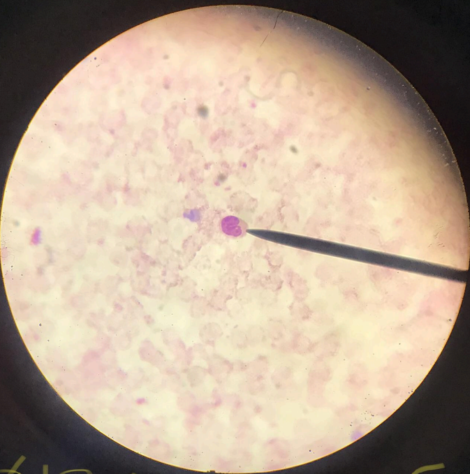 <p>a type of agranulocyte; much bigger than lymphocytes; nucleus is indented and kidney-shaped/horseshoe-shaped</p>