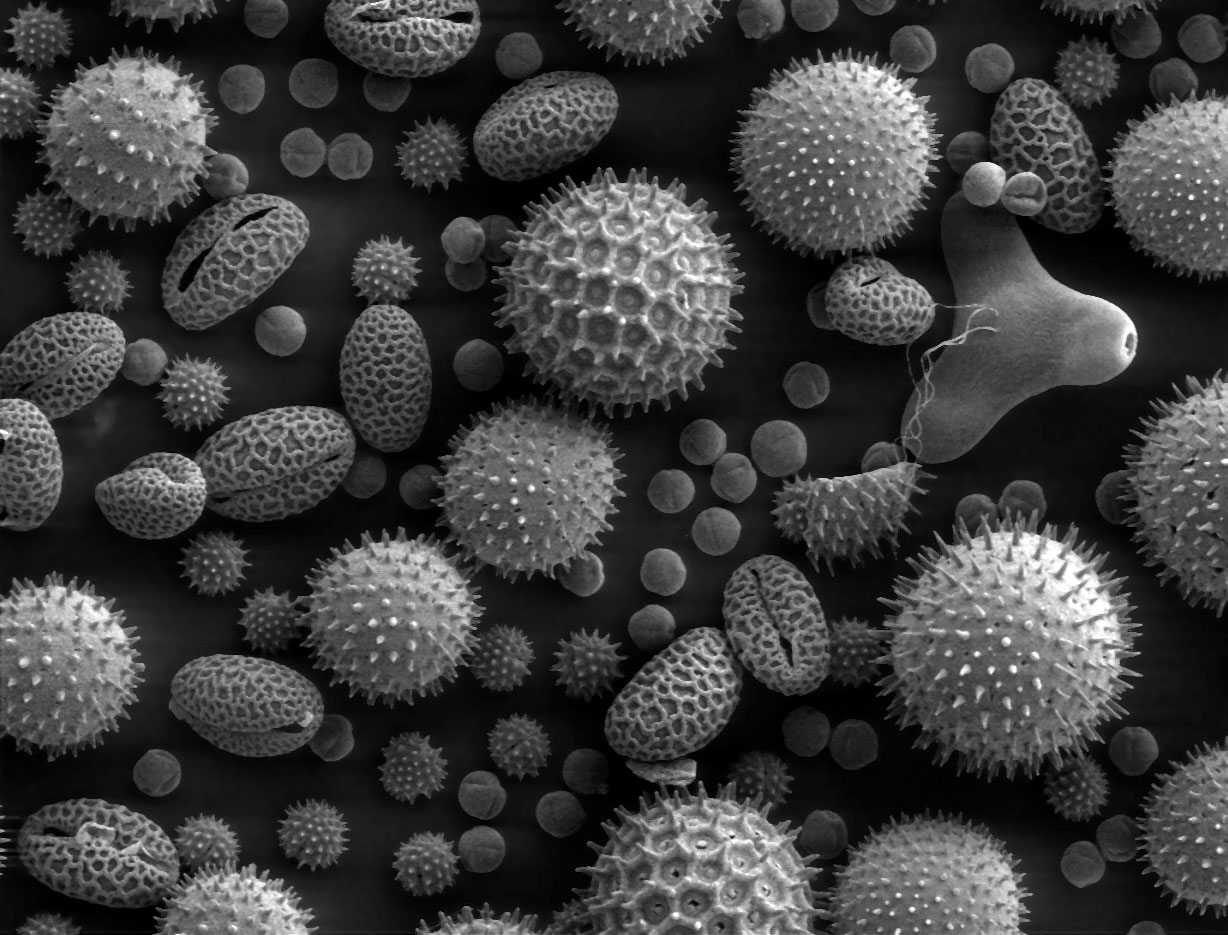 <ul><li><p>High resolution with surface level detail (texture, shape, etc)</p></li><li><p>Ideal for viewing external surfaces of cells, tissues, and molecules</p><p>Disadvantages</p></li><li><p>High cost and kill the cell by dehydration</p></li></ul><p></p>